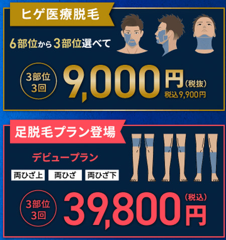 L4.�q�Q�E�� ��������(RT-FRG)